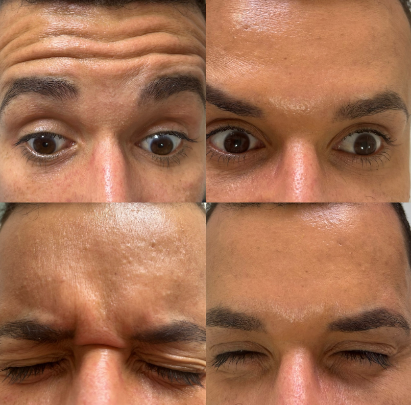 Resultado 2